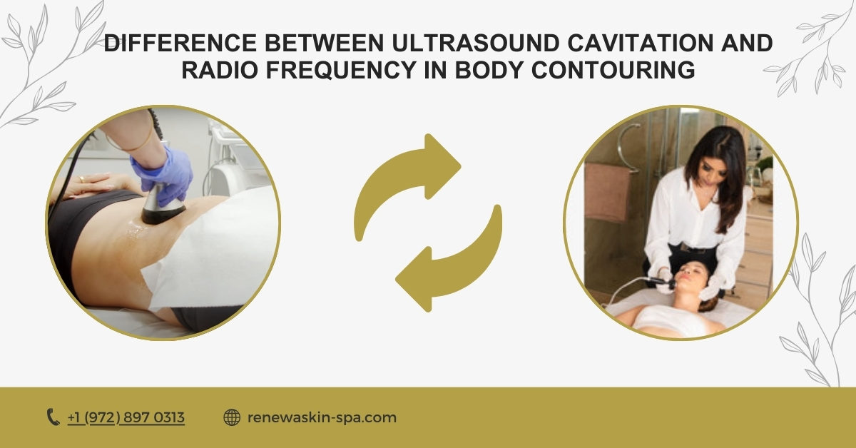 Difference Between Ultrasound Cavitation and Radio Frequency in Body Contouring