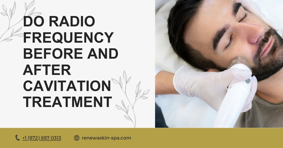 Do Radio Frequency Before and After Cavitation Treatment