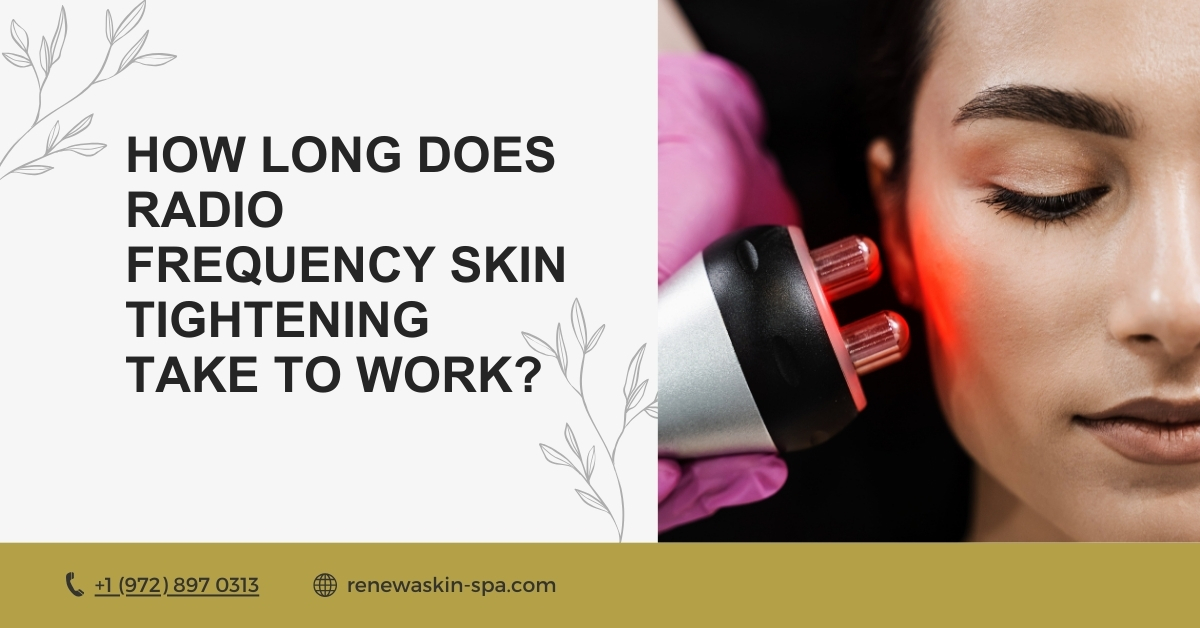 How Long Does Radio Frequency Skin Tightening Take to Work