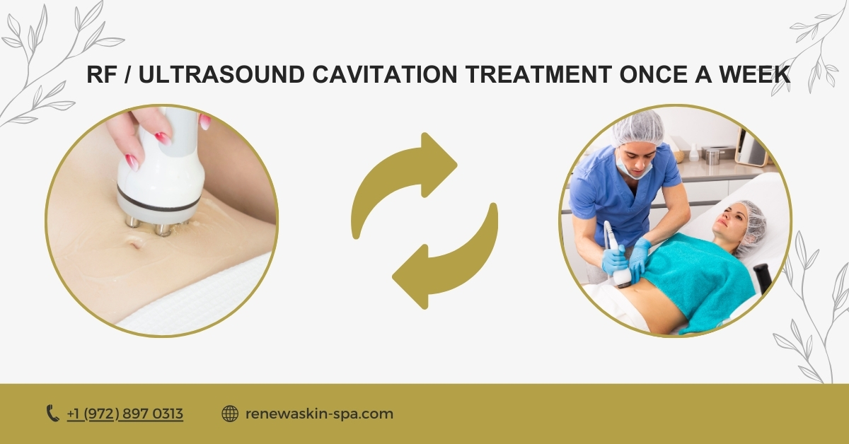 RF  Ultrasound Cavitation Treatment Once a Week