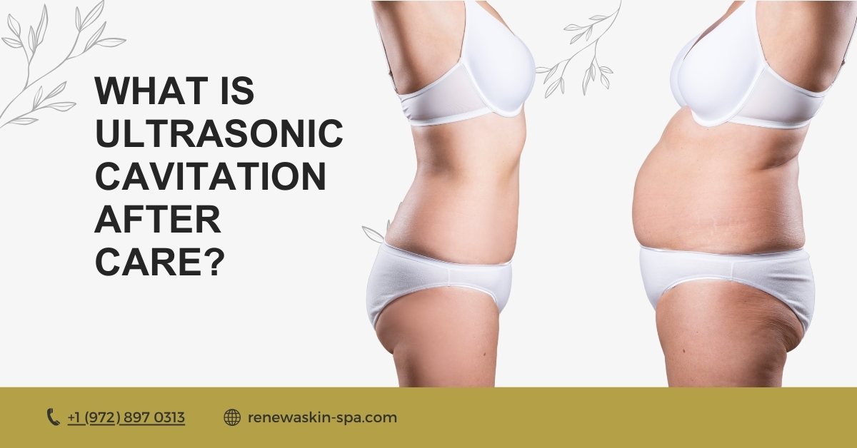 What is Ultrasonic Cavitation After Care